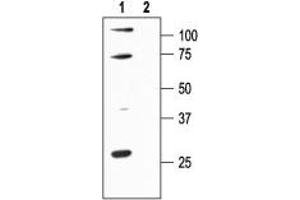 KCNN1 antibody  (Intracellular, N-Term)