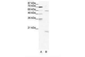 Image no. 1 for anti-SRY (Sex Determining Region Y)-Box 9 (SOX9) (AA 34-83) antibody (ABIN202687) (SOX9 antibody  (AA 34-83))
