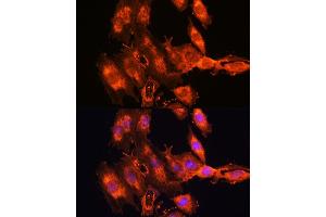 Immunofluorescence analysis of C6 cells using FSTL1 antibody (ABIN7267227) at dilution of 1:100. (FSTL1 antibody  (AA 1-308))