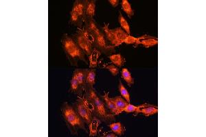 Immunofluorescence analysis of C6 cells using FSTL1 antibody (ABIN7267227) at dilution of 1:100. (FSTL1 antibody  (AA 1-308))