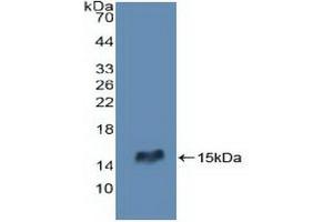 Western blot analysis of recombinant Human RIPK2. (RIPK2 antibody  (AA 432-540))