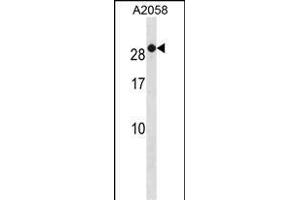 RAB7B Antibody (C-term) (ABIN1881722 and ABIN2838881) western blot analysis in  cell line lysates (35 μg/lane).