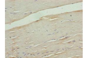 CACNA2D1 antibody  (AA 577-717)