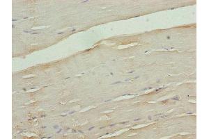 Immunohistochemistry of paraffin-embedded human skeletal muscle tissue using ABIN7175577 at dilution of 1:100 (CACNA2D1 antibody  (AA 577-717))