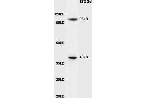 Cyclin M2 抗体  (AA 51-150)