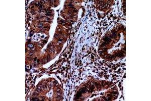 Immunohistochemical analysis of FABP2 staining in human small intestine formalin fixed paraffin embedded tissue section. (FABP2 antibody  (C-Term))