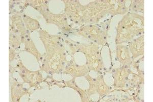 Immunohistochemistry of paraffin-embedded human kidney tissue using ABIN7148290 at dilution of 1:100 (TMEM27 antibody  (AA 15-141))