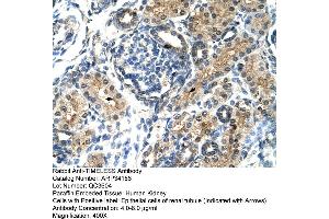Human kidney (TIMELESS antibody  (N-Term))