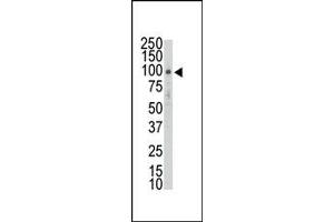 Image no. 1 for anti-Discoidin Domain Receptor tyrosine Kinase 2 (DDR2) (AA 297-327), (AA 304-320) antibody (ABIN359956) (DDR2 antibody  (AA 297-327, AA 304-320))