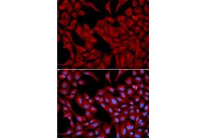 Immunofluorescence analysis of U2OS cell using DCTN2 antibody. (Dynamitin antibody  (AA 50-320))