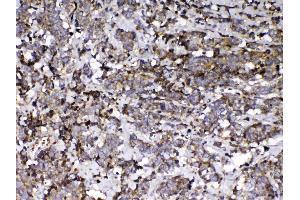 IHC analysis of Vitamin D Binding protein using anti-Vitamin D Binding protein antibody . (Gc (AA 17-256) antibody)
