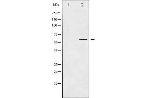 Western blot analysis of COT expression in LPS treated 293 whole cell lysates,The lane on the left is treated with the antigen-specific peptide. (MAP3K8 antibody  (Internal Region))