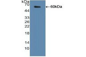 Detection of Recombinant SHMT2, Human using Polyclonal Antibody to Serine Hydroxymethyltransferase 2, Mitochondrial (SHMT2) (SHMT2 antibody  (AA 30-504))