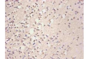 Immunohistochemical of paraffin-embedded human brain tissue using ABIN7152718 at dilution of 1:200 (FTL antibody)
