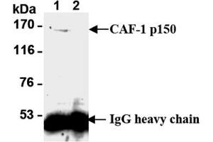 Western Blotting (WB) image for anti-Chromatin Assembly Factor 1, Subunit B (p60) (CHAF1B) antibody (ABIN1105633) (CHAF1B antibody)