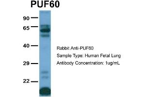 Host:  Rabbit  Target Name:  PUF60  Sample Type:  Human Fetal Lung  Antibody Dilution:  1.