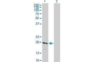 Western Blot analysis of RNF122 expression in transfected 293T cell line by RNF122 monoclonal antibody (M01), clone 5E5. (RNF122 antibody  (AA 61-155))