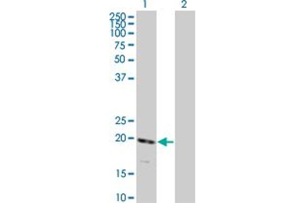 RNF122 antibody  (AA 61-155)