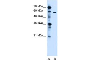 Western Blotting (WB) image for anti-Zinc Finger, DHHC-Type Containing 13 (ZDHHC13) antibody (ABIN2462814) (ZDHHC13 antibody)
