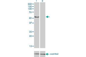 Western blot analysis of IRX6 over-expressed 293 cell line, cotransfected with IRX6 Validated Chimera RNAi (Lane 2) or non-transfected control (Lane 1). (IRX6 antibody  (AA 337-446))