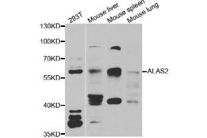 Western blot analysis of extracts of various cell lines, using ALAS2 antibody. (ALAS2 antibody)