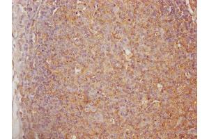 IHC image of ABIN7147565 diluted at 1:100 and staining in paraffin-embedded human lymph node tissue performed on a Leica BondTM system. (Chitotriosidase 1 antibody  (AA 215-430))