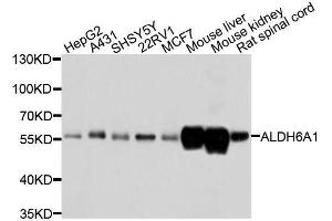 Western blot analysis of extracts of various cell lines, using ALDH6A1 antibody. (ALDH6A1 antibody  (AA 326-535))
