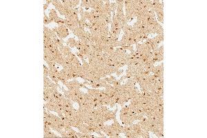 (ABIN6244226 and ABIN6577745) staining WDR82 in human brain tissue sections by Immunohistochemistry (IHC-P - paraformaldehyde-fixed, paraffin-embedded sections). (WDR82 antibody  (N-Term))