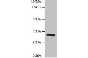 Western blot All lanes: PPP1R3B antibody at 6 μg/mL + Mouse liver tissue Secondary Goat polyclonal to rabbit IgG at 1/10000 dilution Predicted band size: 33 kDa Observed band size: 33 kDa (PPP1R3B antibody  (Regulatory Subunit 3B))