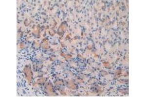 IHC-P analysis of Mouse Stomach Tissue, with DAB staining, using IL12Rb2 Antibody (20 μg/ml) and HRP-conjugated Goat Anti-Rabbit antibody (abx400043, 2 µg/ml).
