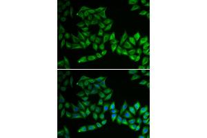 Immunofluorescence analysis of U2OS cells using TPMT antibody.