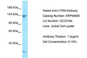 Western Blotting (WB) image for anti-RNA Polymerase-Associated Protein CTR9 Homolog (CTR9) (C-Term) antibody (ABIN2789925) (CTR9 antibody  (C-Term))