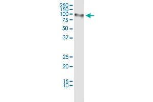 Immunoprecipitation (IP) image for MALT1 (Human) IP-WB Antibody Pair (ABIN2752030)