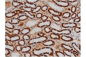 ABIN6267399 at 1/200 staining Rat kidney tissue sections by IHC-P.