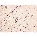 anti-Phosphoinositide 3 Kinase, p85 alpha/gamma (PI3K p85a/g) (pTyr199), (pTyr467) antibody