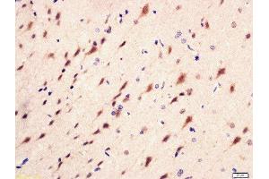 Immunohistochemistry (Paraffin-embedded Sections) (IHC (p)) image for anti-Phosphoinositide 3 Kinase, p85 alpha/gamma (PI3K p85a/g) (pTyr199), (pTyr467) antibody (ABIN744743)