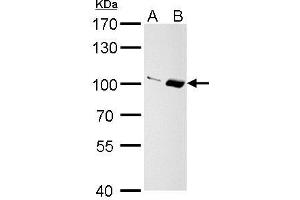 WB Image Importin 13 antibody [C3], C-term detects Importin 13 protein by Western blot analysis.