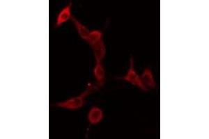 ABIN6275911 staining  HeLa cells by IF/ICC. (Serotonin Receptor 5A antibody  (Internal Region))