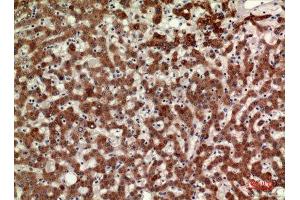 Immunohistochemistry (IHC) analysis of paraffin-embedded Human Liver, antibody was diluted at 1:100. (MPL antibody  (Internal Region))