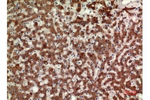 Immunohistochemistry (IHC) analysis of paraffin-embedded Human Liver, antibody was diluted at 1:100.