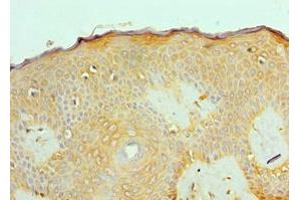 Immunohistochemistry of paraffin-embedded human skin tissue using ABIN7143180 at dilution of 1:100 (ACVR2A antibody  (AA 20-140))