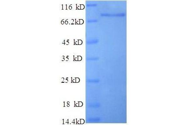 DPP6 Protein (AA 111-859) (His tag)