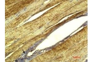 Expression of CaVγ1 (CACNG1) in rat skeletal muscle - Immunohistochemical staining of paraffin-embedded rat skeletal muscle sections using Anti-CACNG1 (extracellular) Antibody (ABIN7042988, ABIN7044053 and ABIN7044054), (1:100), followed by DAB. (CACNG1 antibody  (Extracellular))