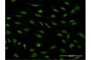 Immunofluorescence of monoclonal antibody to OXSR1 on HeLa cell. (OXSR1 antibody  (AA 351-450))