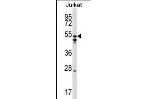 HNRNPH2 Antibody (C-term) (ABIN657420 and ABIN2846457) western blot analysis in Jurkat cell line lysates (35 μg/lane).