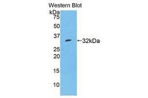 Western Blotting (WB) image for anti-Serpin Family A Member 7 (SERPINA7) (AA 127-393) antibody (ABIN1078580) (SERPINA7 antibody  (AA 127-393))