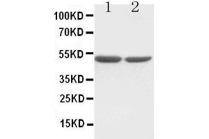 Anti-c-Fos antibody, Western blotting Lane 1:  Cell Lysate Lane 2: COLO320 Cell Lysate (c-FOS antibody  (Middle Region))