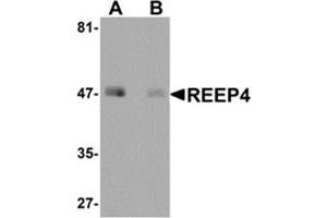 Western blot analysis of REEP4 in human lung tissue lysate with REEP4 antibody at 1 μg/ml in (A) the absence and (B) the presence of blocking peptide. (Receptor Accessory Protein 4 antibody  (Center))