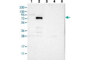 Western blot analysis of Lane 1: RT-4, Lane 2: U-251 MG, Lane 3: Human Plasma, Lane 4: Liver, Lane 5: Tonsil with VEZT polyclonal antibody .