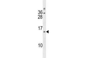 LIMS3L / LIMS3 antibody western blot analysis in 293 lysate. (LIMS3 antibody  (AA 28-54))